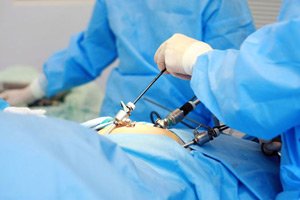 Laparoscopic surgery. AVICENNA MED, Kyiv