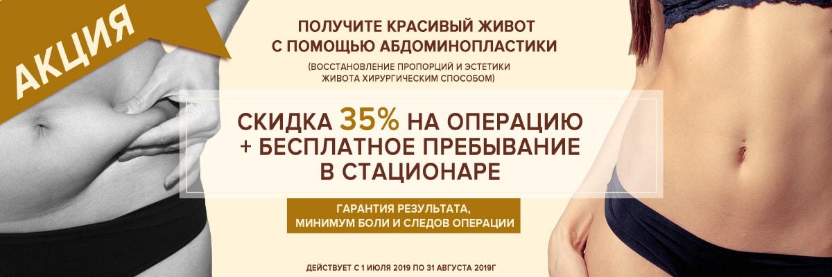 Акция на пластику живота - клиника АВИЦЕННА МЕД, Киев